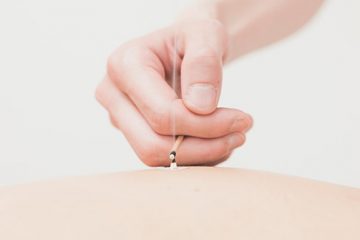 武蔵小杉の鍼灸院 武蔵小杉はりきゅうここわ