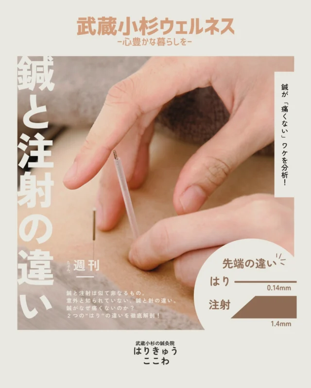 【鍼治療の「鍼」と、病院の「注射針」
実はまったくの別モノだってご存じでしたか？

「鍼って痛そう・・」と不安に思っている方に、ぜひ知ってほしい2つの大きな違いをご紹介します！

①太さが圧倒的に違う！
病院で使われる一番“細い”注射針（採血用など）でも0.4mm〜0.5mm。

それに対して、当院で普段使っている鍼灸用の鍼は、
約0.14mm〜0.16mm！

実に髪の毛ほどの細さしかありません。

先端の形状も「痛みを最小限に抑える構造」にカットされているため、刺されたことすら気づかない患者様も多いんです。

②「響き」と「狙い」をコントロールする職人技術

ただ細い針を入れているだけではありません。

当院では、お一人おひとりの筋肉やツボ（経穴）の深さを正確に見極め、指先の微細な感覚だけで0.1ミリ単位のコントロールを行っています。

痛みを一切感じさせない優しいアプローチ

お身体の状態やその日のコンディションに合わせて鍼の打ち分けや響かせ方を調整する、職人技のような技術にこだわっています技術の粋を集めて施術しています。

「痛そうだから・・」と鍼治療をためらっていた方こそ、ぜひ一度この優しさと効果を体験してみてください！

ご予約・ご相談はプロフィールのリンク（ @harikyu_kokowa）からお気軽にどうぞ！

#武蔵小杉鍼灸 #武蔵小杉 #鍼灸 #はりきゅう #武蔵小杉で鍼灸のある心地よい暮らし #武蔵小杉鍼灸院